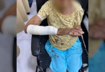 Adulta mayor es atacada por perro en Nuevo Laredo