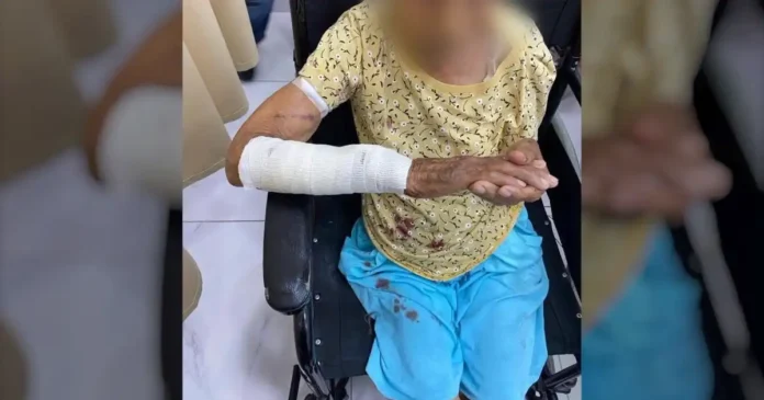 Adulta mayor es atacada por perro en Nuevo Laredo
